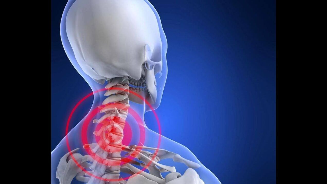 Osteocartilage of the cervical vertebra