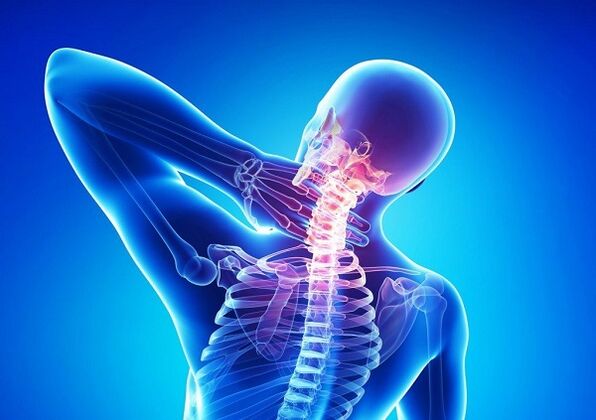 Cervical pain with osteochondrosis
