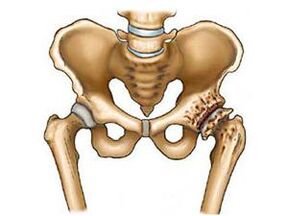What is hip joint