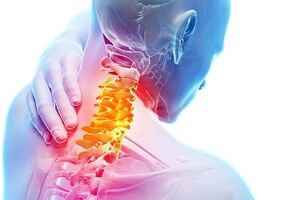 The main signs and symptoms of cervical osteochondrosis
