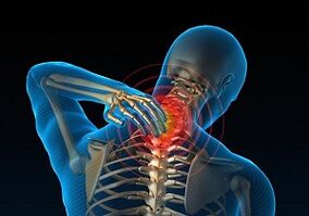 Why development and how cervical osteochondral disease manifests
