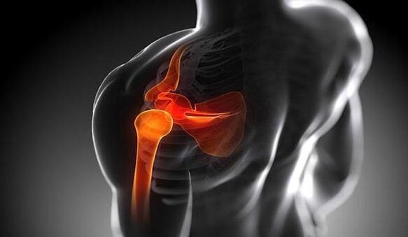 Shoulder joint injuries caused by joints