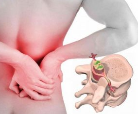 Low back pain at the beginning of the disease osteochondrosis
